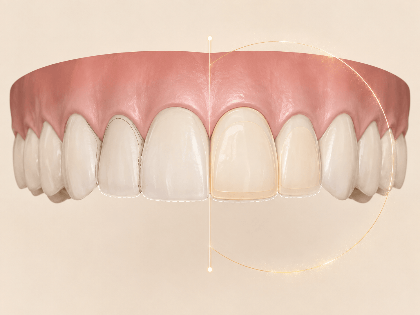 Generated anterior treatment-planning render comparing restorative symmetry options in the LUMOSCO clinical visual style